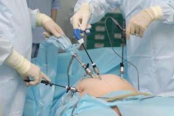 У Волинській обласній клінічній лікарні скоро буде відділ лапароскопічної хірургії