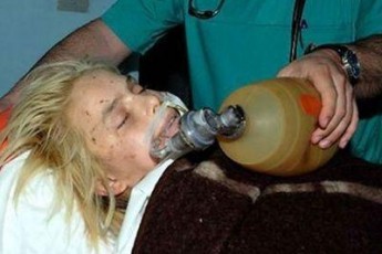 Оксана Макар померла через сильну кровотечу з легень і зупинку серця