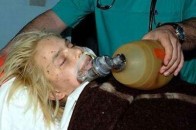 Оксана Макар померла через сильну кровотечу з легень і зупинку серця