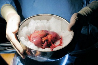 Українська влада хоче забирати органи у померлих