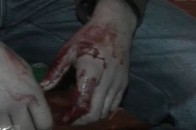 На Волині дівчина, розбороняючи парубків, отримала ножове поранення в живіт