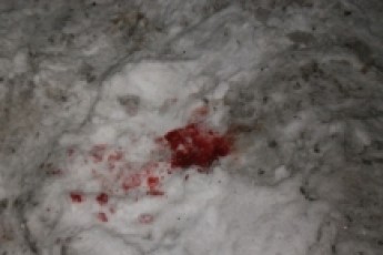 Правоохоронці відшукали автомобіль, який збив матір з дитиною в центрі Луцька