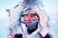 Цієї зими від обмороження постраждало 14 волинян
