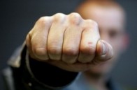 У Луцьку двоє чоловіків безпричинно побили хлопця