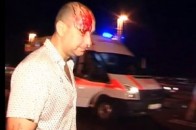 ЗМІ: У Києві міліціонер збив лікаря, який намагався допомогти постраждалому