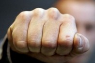 У Луцьку засудили грабіжника, який через 100 гривень підбив око своєму знайомому