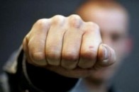 У Володимирі-Волинському чаркування на зупинці завершилося зламаною щелепою