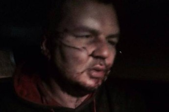 Викраденого лідера Автомайдану тиждень катували та віздрізали вухо