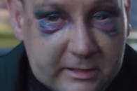 Чоловіка, якого визволили з полону бойовиків, розповів про тортури в Донецькій ОДА ВІДЕО