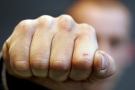 Неповнолітній волинянин з «напарником» відгамселили знайомого