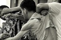 Відпочинок у барі завершився для волинянина зламаною щелепою