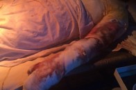 Росіяни кілька годин допитували обгорілих солдат 79-ї бригади ВІДЕО