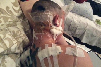 Волинському бійцю потрібна негайна допомога ФОТО