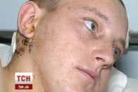 У волинянина, який їхав на зачистку, тричі влучили з гранатомета