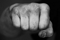 Волинянину поламали ногу, за те що заступився за сусідку