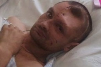 Волинський боєць отримав важке поранення