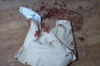 У Києві в гуртожитку стався вибух: один загинув і двоє тяжкопоранених