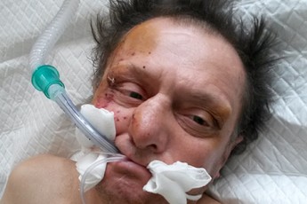 На Волині поблизу дороги знайшли людину без пам’яті ФОТО