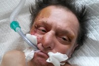 На Волині поблизу дороги знайшли людину без пам’яті ФОТО