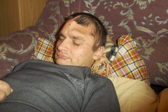 Важкопоранений боєць з Волині потребує термінового лікування і реабілітації ФОТО