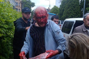 У Луцьку медики швидкої проігнорували чоловіка, який стікав кров’ю, - ЗМІ ФОТО