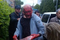 У Луцьку медики швидкої проігнорували чоловіка, який стікав кров’ю, - ЗМІ ФОТО