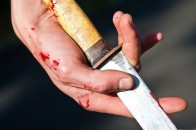 Лучанин захищаючись від банди хуліганів підрізав нападника