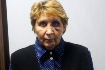 Свідок готовий опізнати молодиків, які побили лучанку через політику*