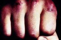 Ката за ґрати: волинянин боїться повертатися додому через рукоприкладство сина