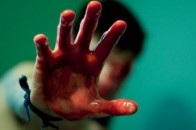 На Волині до смерті побили 18-річного хлопця