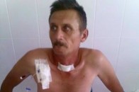 Волинський боєць, який пережив 11 операцій, повертається додому. ФОТО