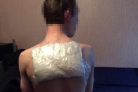 Наркокур’єр намагався пронести повз митників на спині кілограм наркотиків. ОНОВЛЕНО