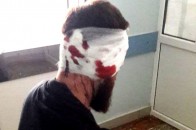 Невідомі жорстоко побили депутата облради