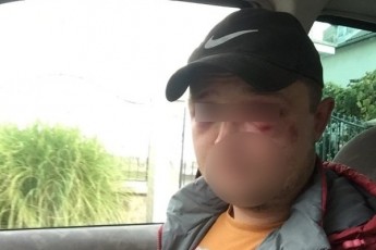 На Закарпатті грибників побили всім селом