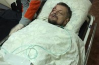 Вибух авто в Києві: поранено нардепа Мосійчука, охоронець загинув