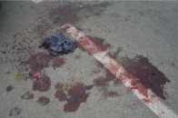 Шкіра зчесана аж до кісток: під Києвом п’яний водій більше кілометра протягнув чоловіка за авто (Відео)
