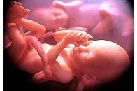 У Запорізькій області народилася дитина-гігант