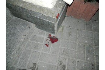П’яні підлітки жорстоко побили чоловіка у Києві