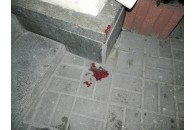 П’яні підлітки жорстоко побили чоловіка у Києві