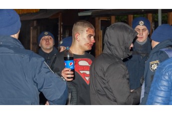 Масову криваву бійку під клубом у Дніпрі втихомирювали кілька екіпажів поліції