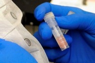 Поляки побоюються епідемії туберкульозу зі сторони України