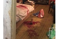 Відрубав пальці на руках: чоловік по-звірячому розправився з дружиною
