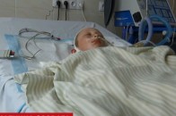 На Рівненщині дитина потрапила у реанімацію після забав на гірці