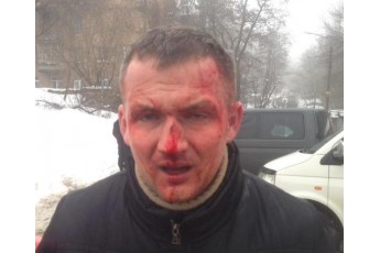 У Києві жорстоко побили нардепа Левченка