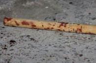 На Волині жінку до смерті забили палицею
