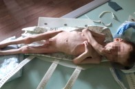 Наче після концтабору: депутат райради морив голодом власну дитину (Відео)