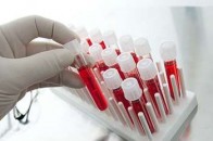Українці отримають можливість безкоштовно здавати аналізи