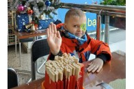 На Волині хлопчику, який народився без ока, потрібні кошти на лікування
