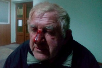У Луцьку невідомі жорстоко побили старенького чоловіка