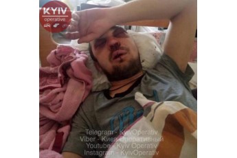 Переломи, травми черепа і мозку: водій маршрутки жорстоко побив пасажира за прохання передати здачу у Києві